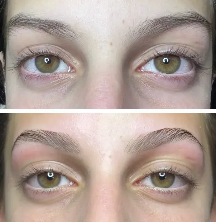 Cejas